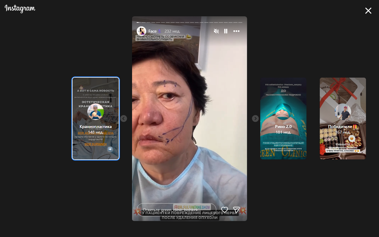 Пластика лица