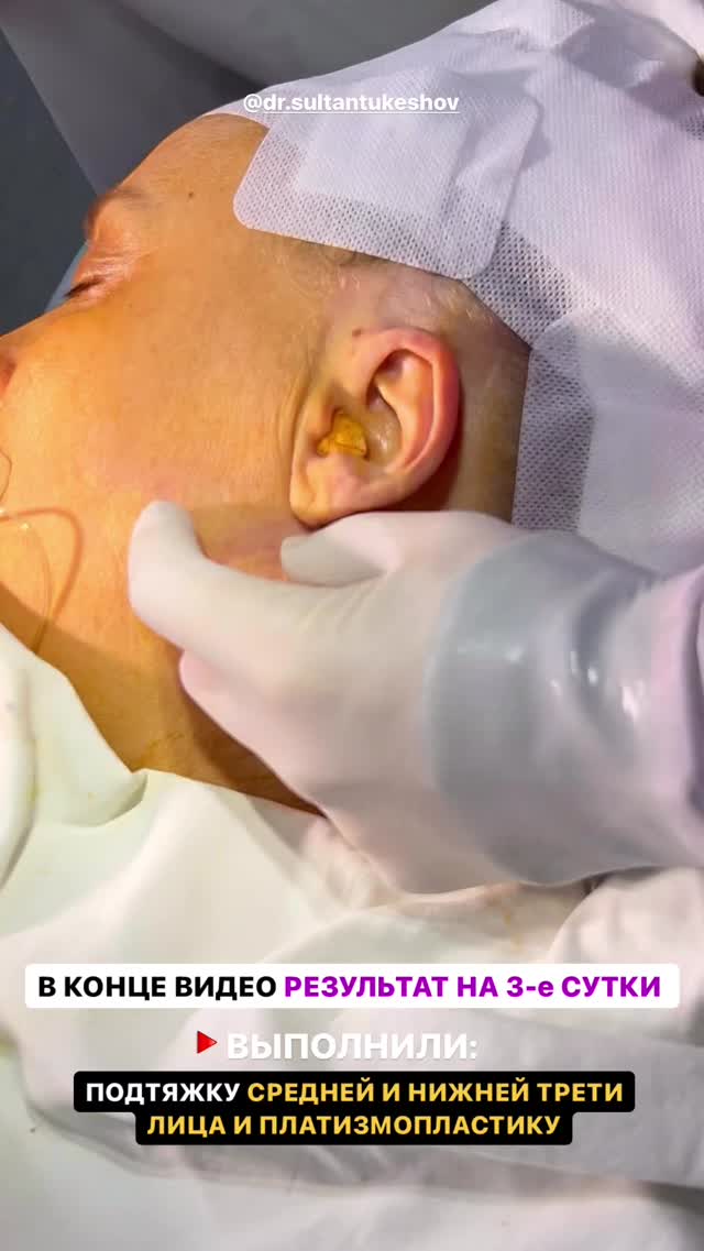 Хирургия лица