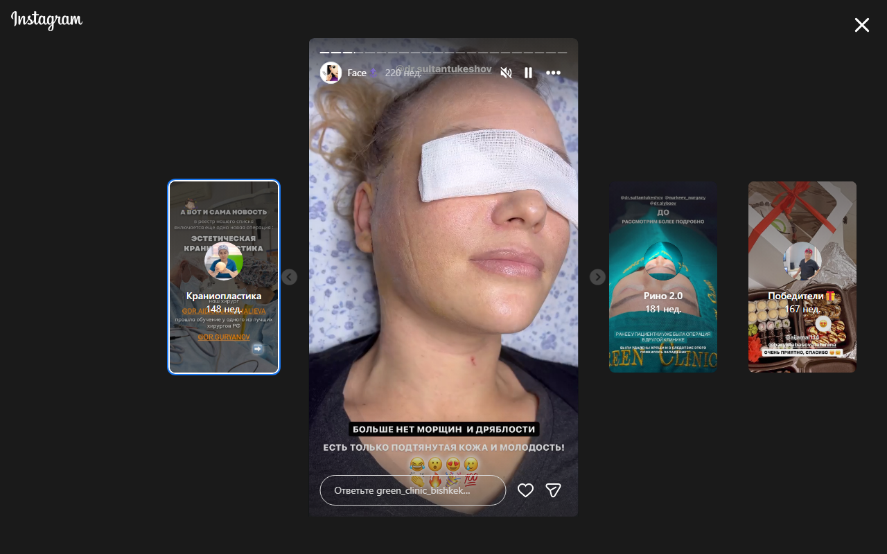 Пластика лица — Green Clinic