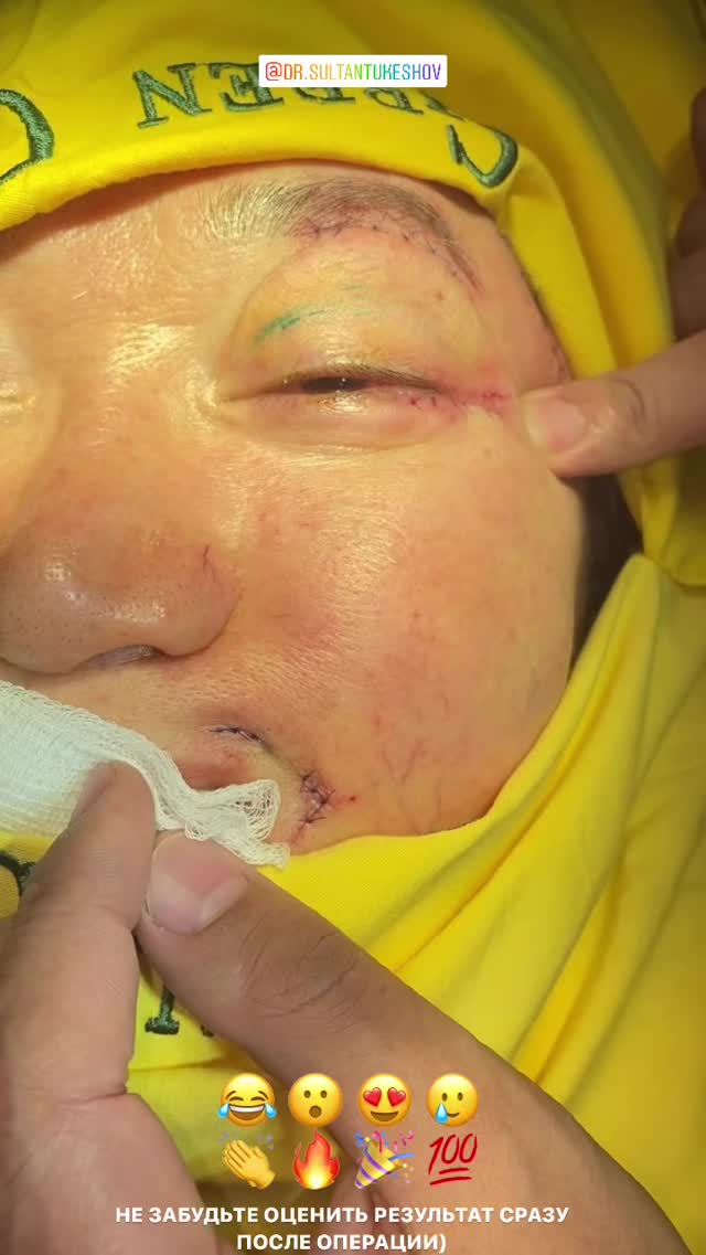 Гинекология