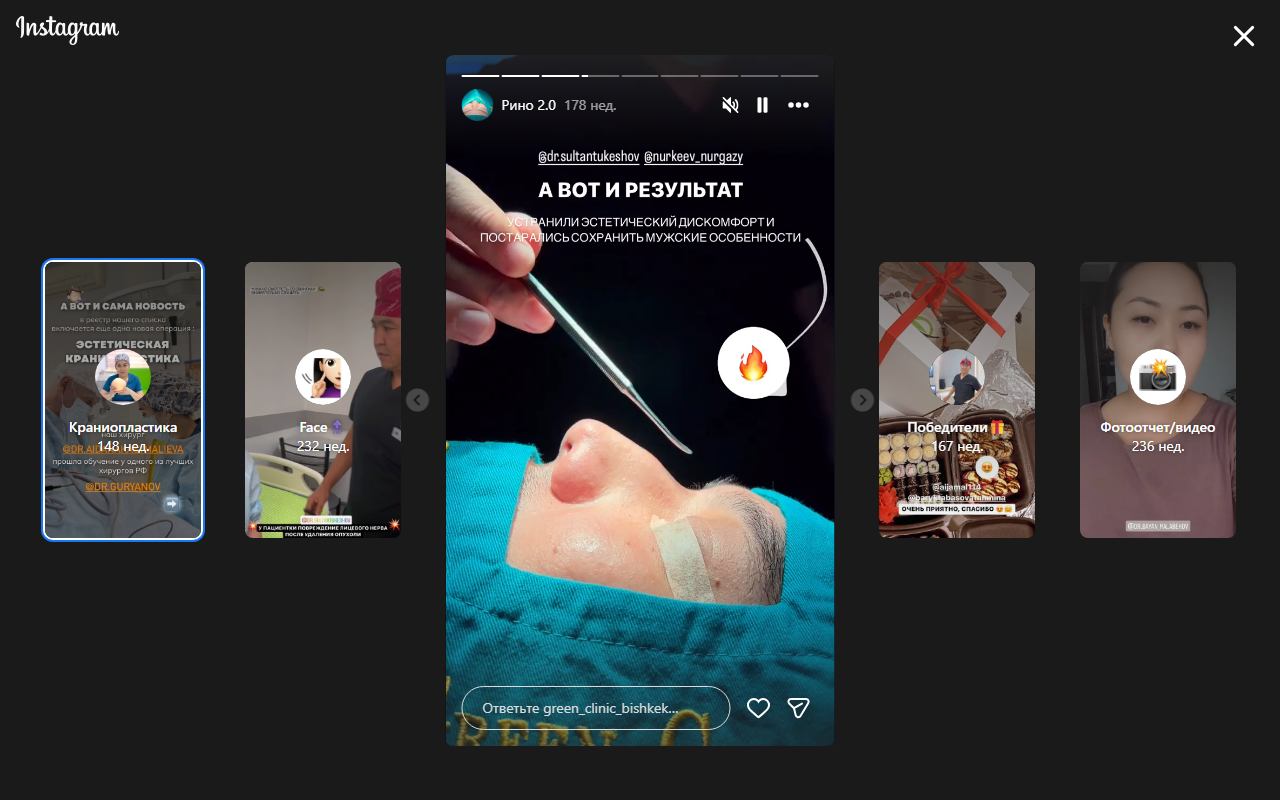 Ринопластика — до