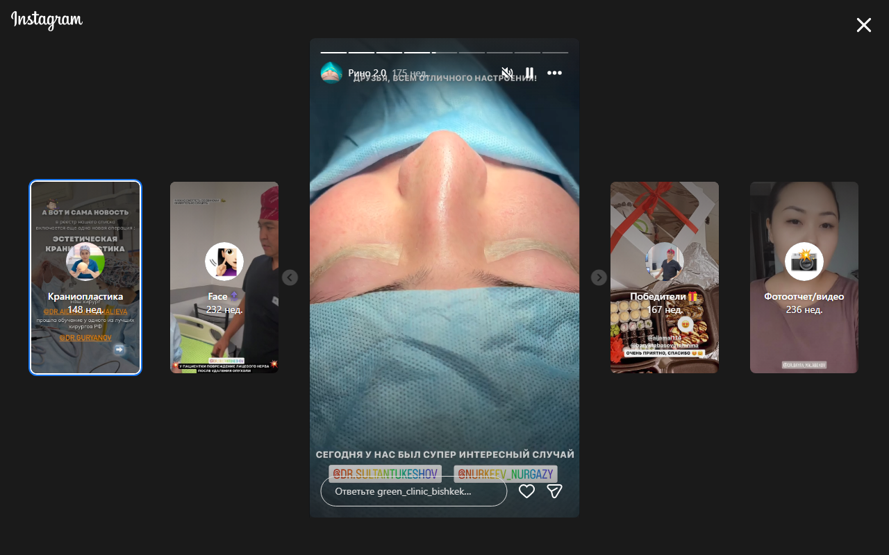 Ринопластика — после