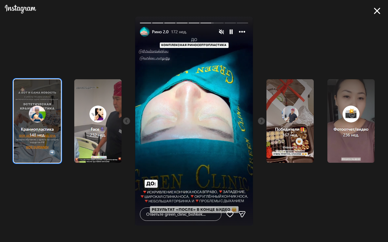 Результат — ринопластика